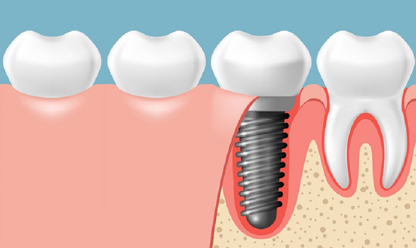 Phòng khám Chuyên khoa Răng – Hàm – Mặt LD Mega Dental