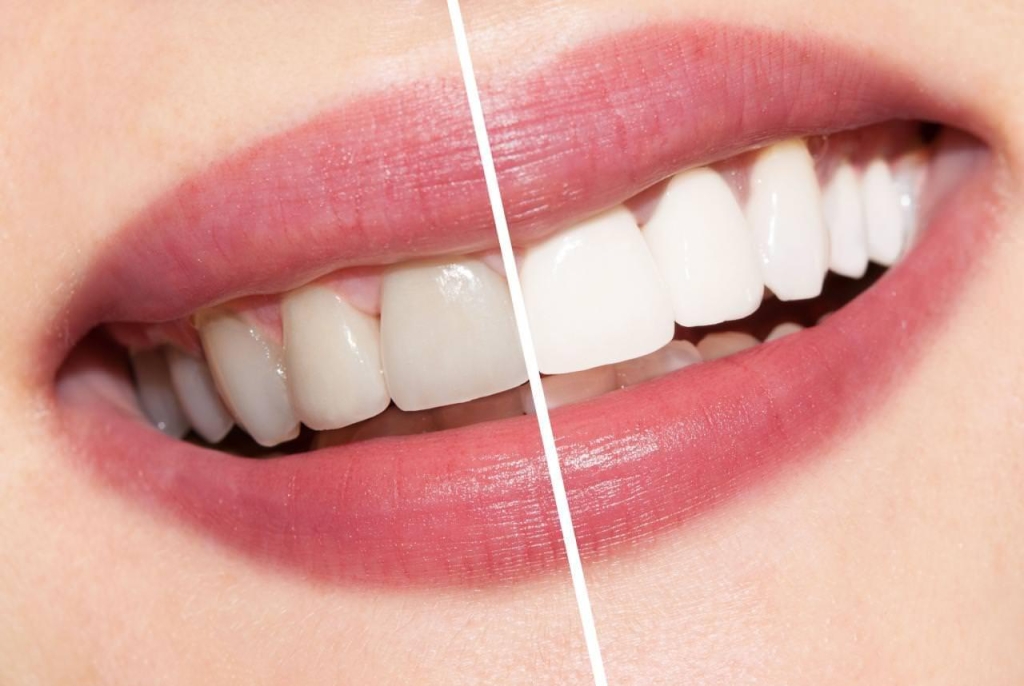Phòng khám Chuyên khoa Răng – Hàm – Mặt LD Mega Dental