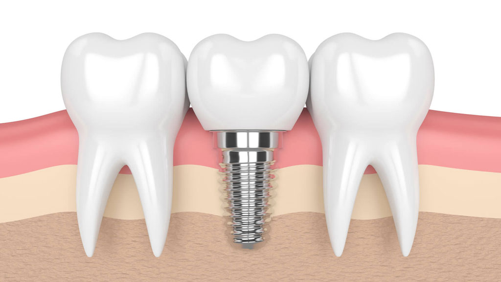 Phòng khám Chuyên khoa Răng – Hàm – Mặt LD Mega Dental